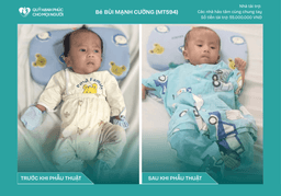 CHÚC MỪNG BÉ BÙI MẠNH CƯỜNG (MT594) ĐÃ ĐƯỢC RA VIỆN ❤️