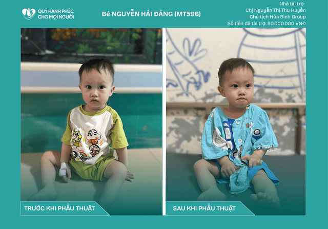 CHÚC MỪNG BÉ NGUYỄN HẢI ĐĂNG (CA SỐ 596) ĐÃ ĐƯỢC RA VIỆN ❤️