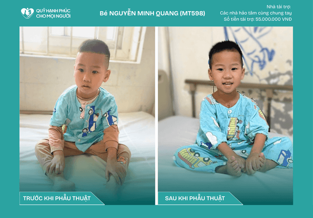 CHÚC MỪNG BÉ NGUYỄN MINH QUANG (MT598) ĐÃ ĐƯỢC RA VIỆN! ❤️