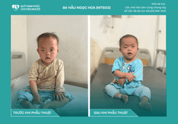 CHÚC MỪNG BÉ HẦU NGỌC HOA (CA SỐ 603) ĐÃ ĐƯỢC RA VIỆN!