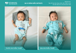 CHÚC MỪNG BÉ VI ĐÌNH BẮC (MT607) ĐÃ ĐƯỢC RA VIỆN ❤️